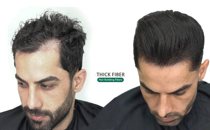 HairMax Natural Hair Building Fibers for Men & Women | Instantly Thicker & Hair Volume